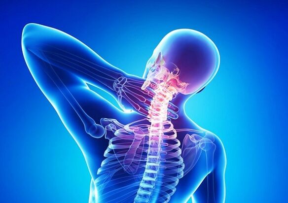 kaklo stuburo skausmas su osteochondroze