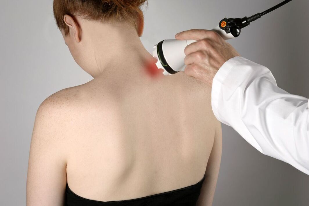 fizioterapinis gimdos kaklelio osteochondrozės gydymas