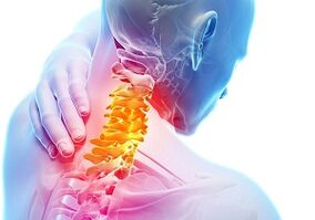Pagrindiniai gimdos kaklelio osteochondrozės požymiai ir simptomai